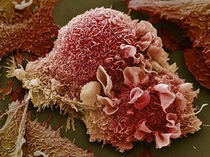 Veliko otkriće u borbi protiv raka – otkriveni tajni agenti u genima koji pomažu tumorima